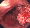 The_Endoscopy_X-ray.bmp